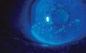 Value your eyes ocular health image