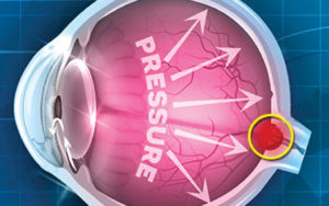 Value your eyes ocular health website image