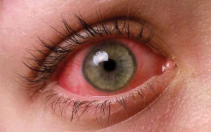 Value your eyes ocular health website image