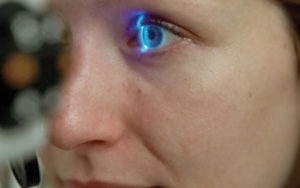 Value your eyes ocular health image