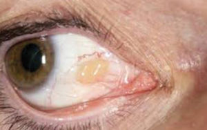 Value your eyes ocular health image