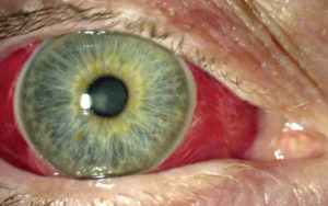 Value your eyes ocular health image