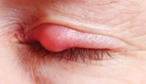 Value your eyes ocular health image
